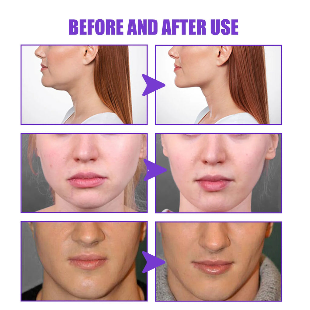 V Face Lifting Slimming Cream
