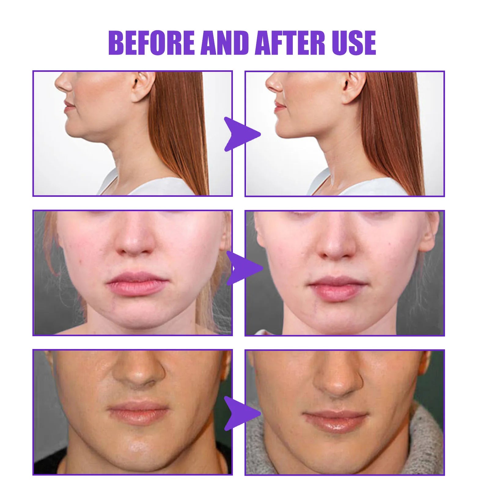 V Face Lifting Slimming Cream