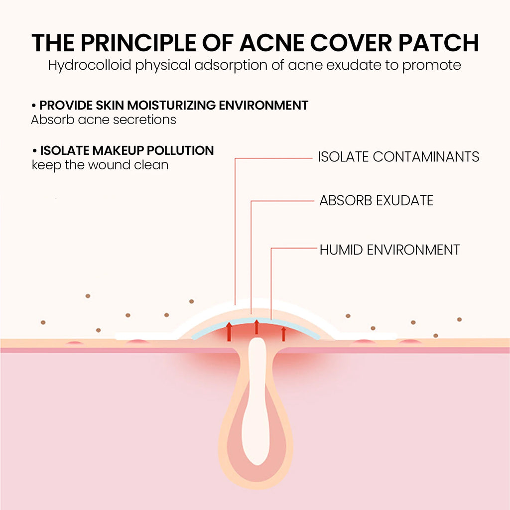 200Pcs Repair Acne Patch
