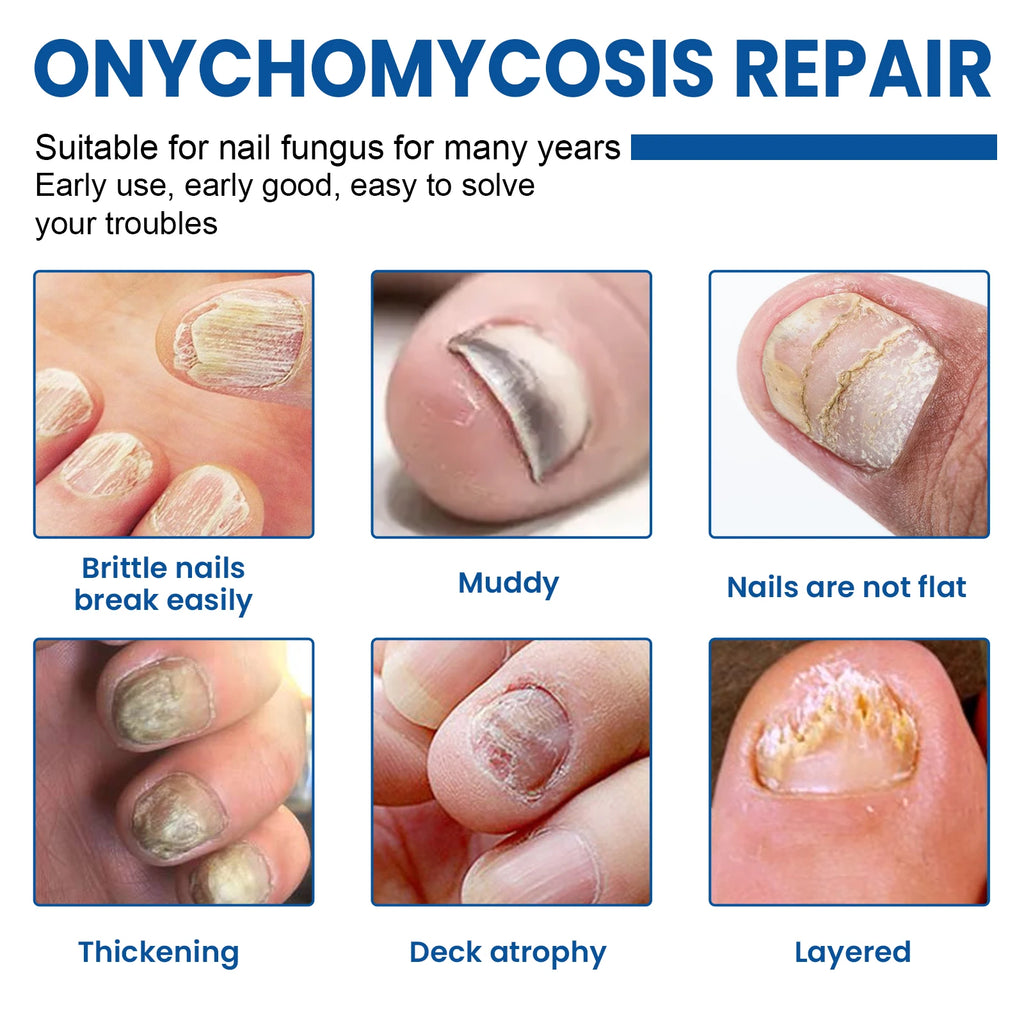 Nail Repair Patches Toenail Fungus