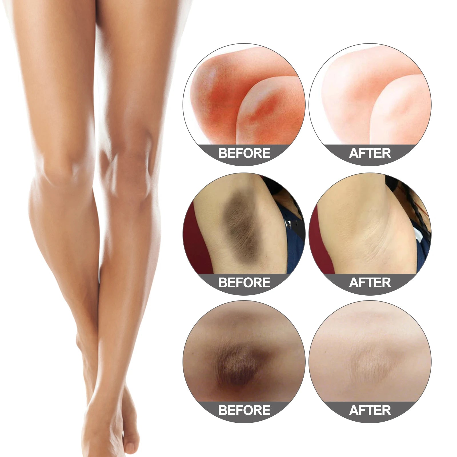 Body Snow Bleach Cream