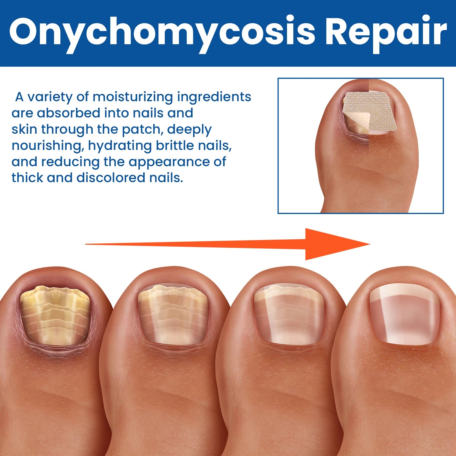 Nail Repair Patches Toenail Fungus