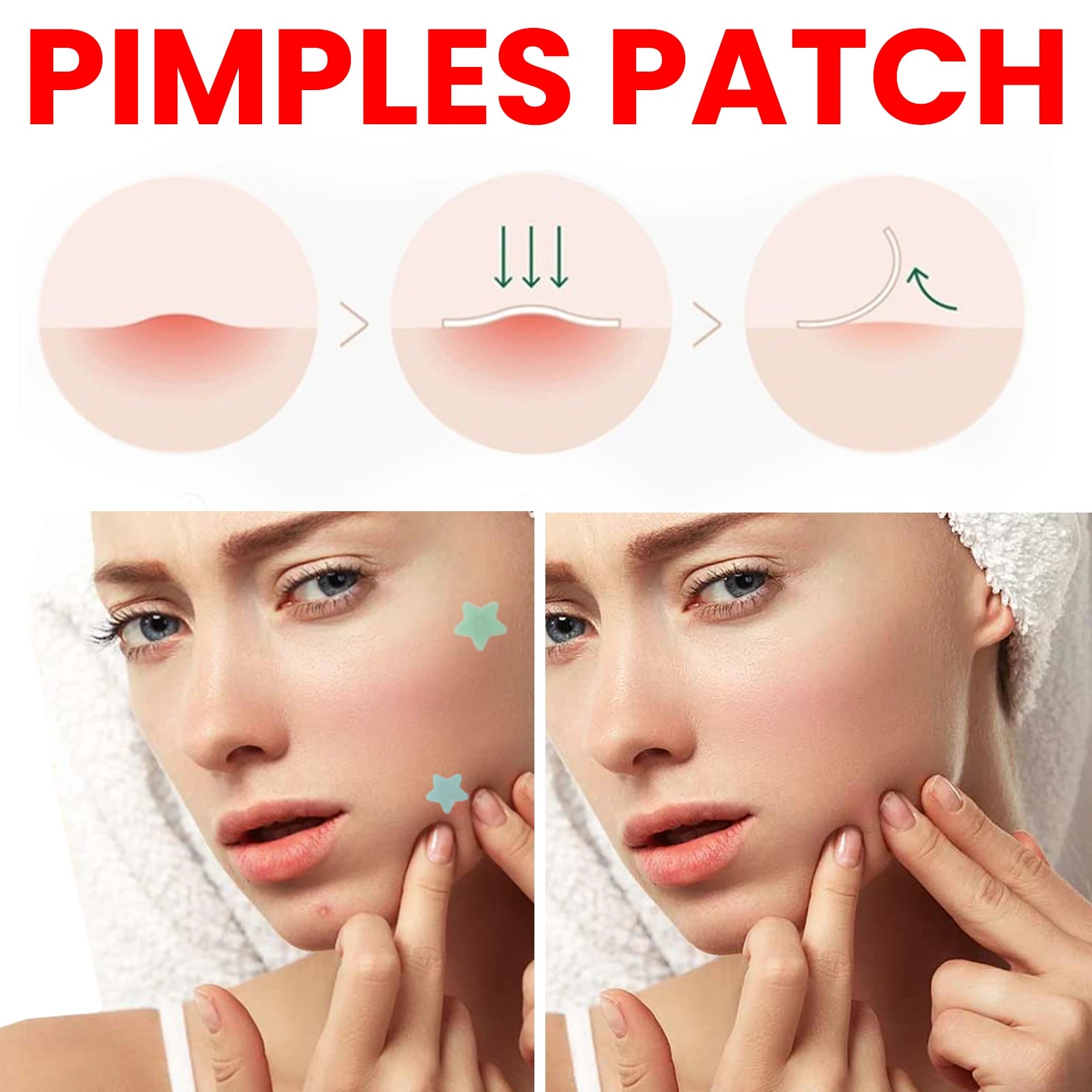 200Pcs Repair Acne Patch