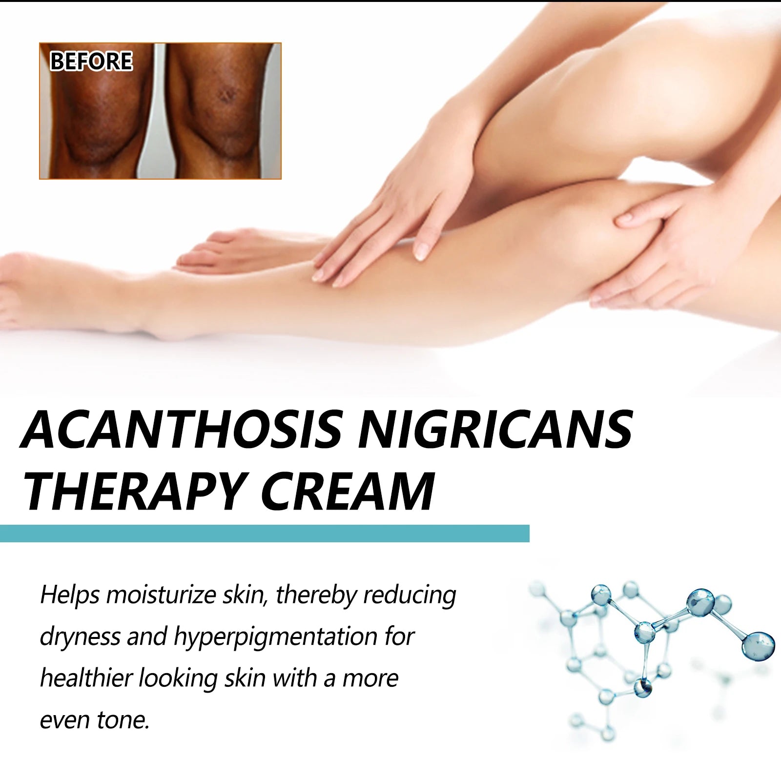 Whitening Cream Brightening Skin