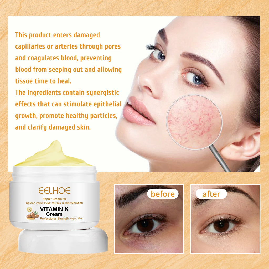 Vitamin K Cream
