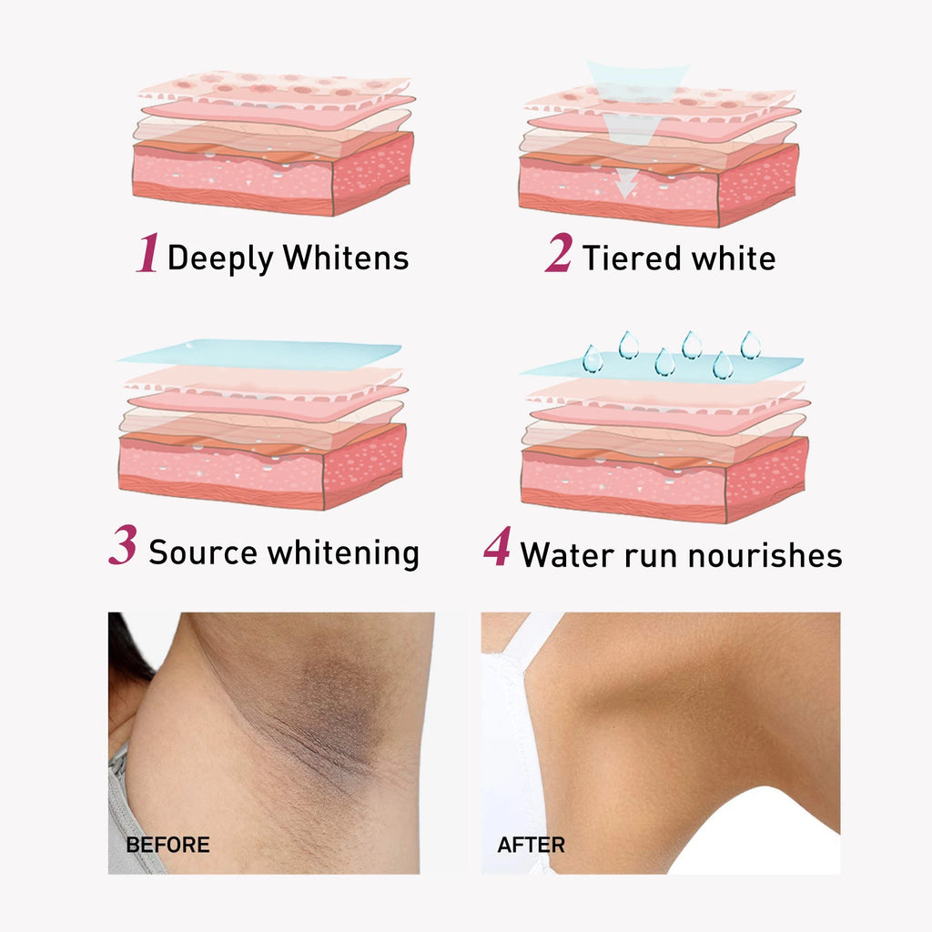 Whitening Cream For Dark Skin