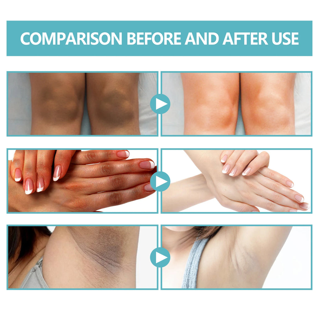 Whitening Cream Brightening Skin